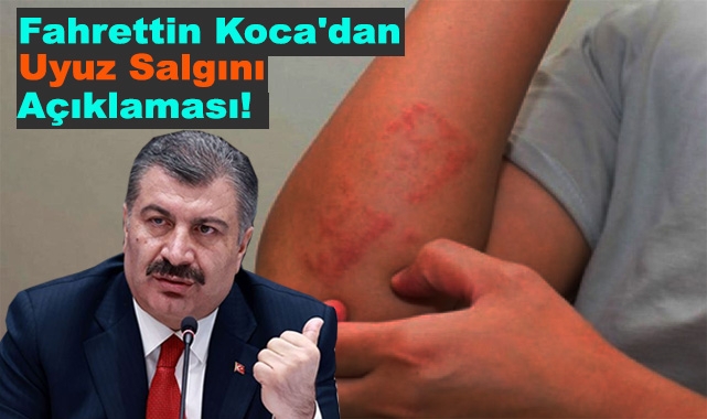 Fahrettin Koca'dan Uyuz Salgını Açıklaması!
